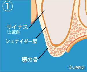 ソケット